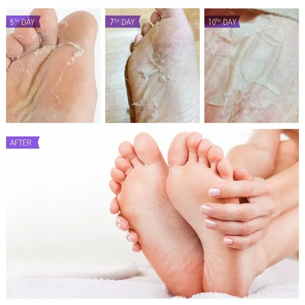 Foot Peel Mask - Exfoliator Peel Off Calluses Dead Skin, Foot Spa and Callus Remover - Baby Soft Smooth Touch Feet with Lavender and Aloe Vera for Men and Women (2 Pairs)