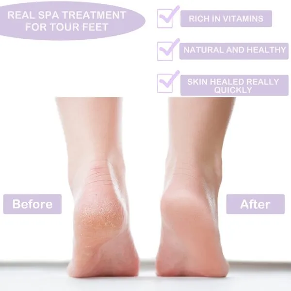 2 Pairs Moisturizing Socks, Gel Socks Soft Moisturizing Gel Socks, Gel Spa Socks for Repairing and Softening Dry Cracked Feet Skins (Purple & Gray)